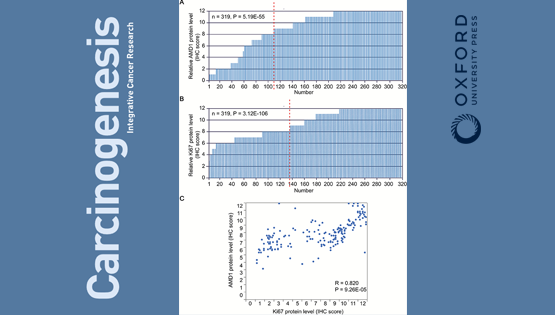 陈雁研究组合作发现多胺代谢在胃癌发生和预后中的作用