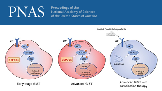 王跃祥研究组合作发现胃肠道间质瘤恶性进展的新机制