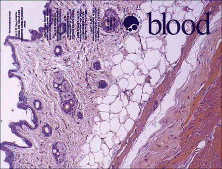 中国科学院上海营养与健康研究院科研人员揭示Hsp90调控Ezh2蛋白稳定性参与移植物抗宿主病的重要机制