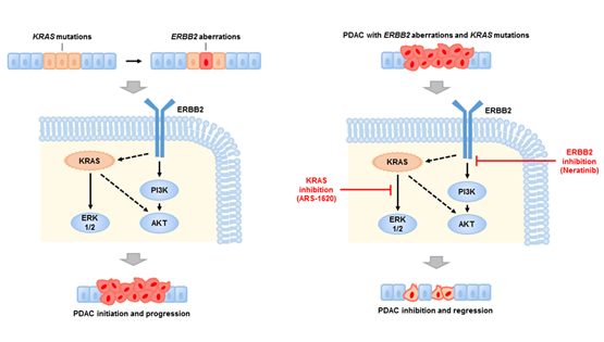 王跃祥研究组发现胰腺癌的新型治疗靶点