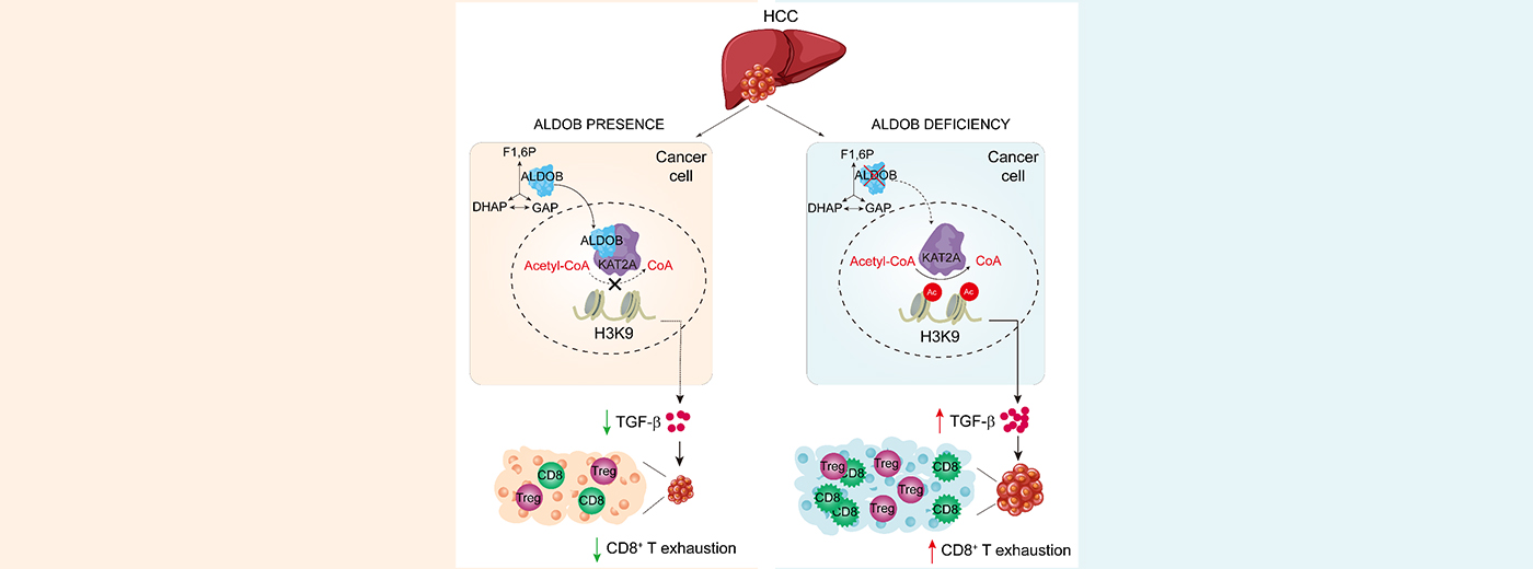 营养与健康所尹慧勇研究组合作发现肝癌肿瘤细胞代谢影响肿瘤免疫新机制